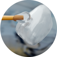 Estetica dental carilla Estetica dental carilla