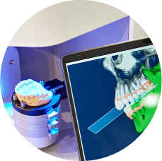 Diseño prótesis dental 3D Diseño protesis dental 3D